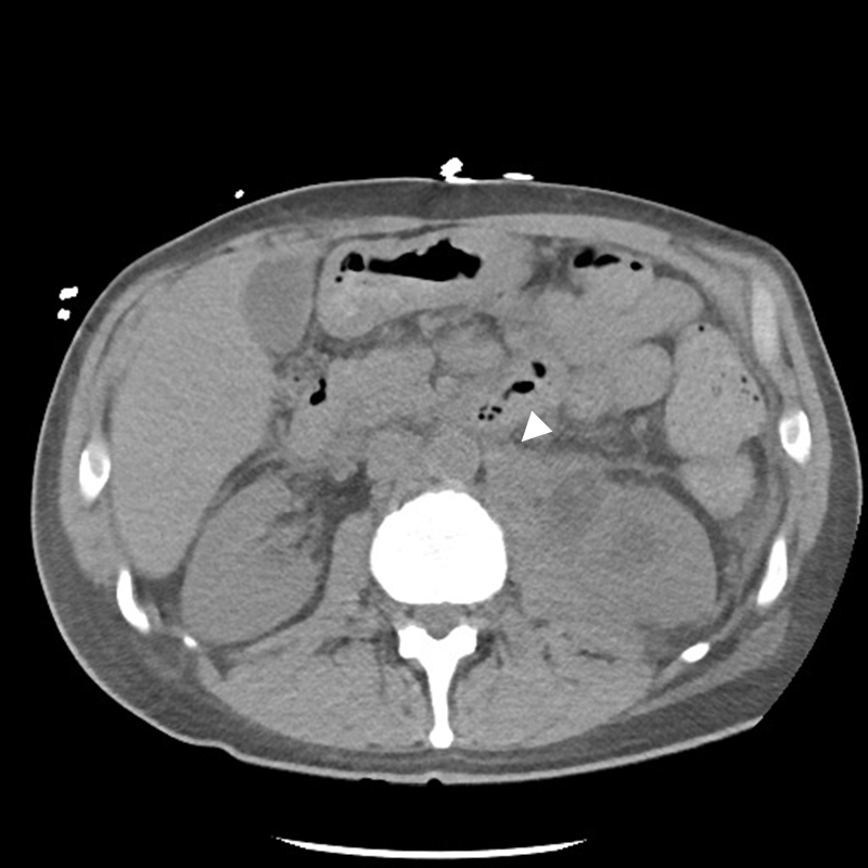 Urology Case 2 | NucsRadiology.com