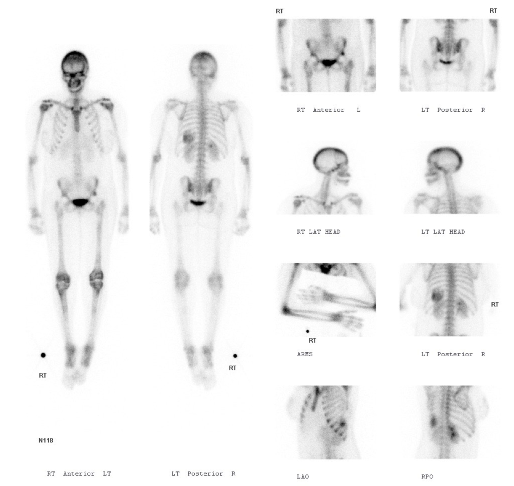 Musculoskeletal Case 3 