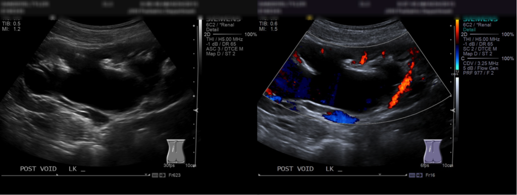 Sagittal Ultrasound images | NucsRadiology.com